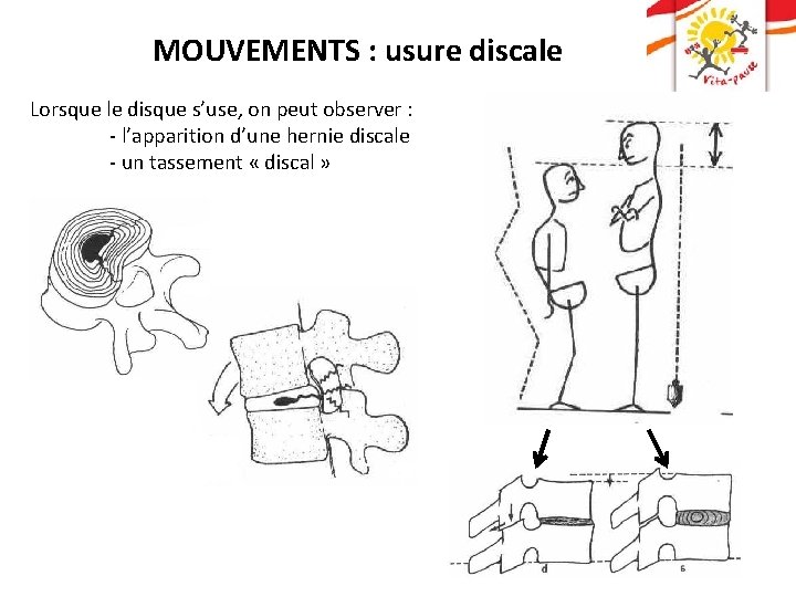 MOUVEMENTS : usure discale Lorsque le disque s’use, on peut observer : - l’apparition