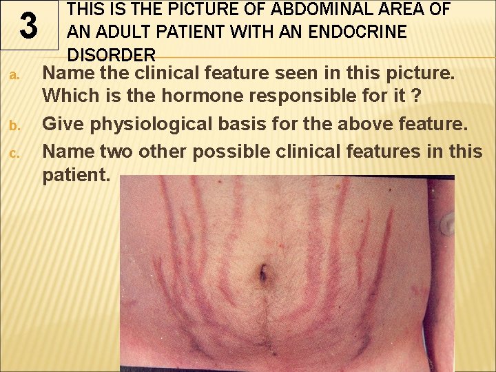 3 a. b. c. THIS IS THE PICTURE OF ABDOMINAL AREA OF AN ADULT