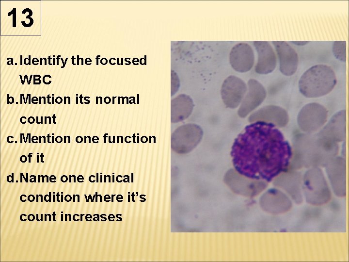 13 a. Identify the focused WBC b. Mention its normal count c. Mention one 13 a. Identify the focused WBC b. Mention its normal count c. Mention one