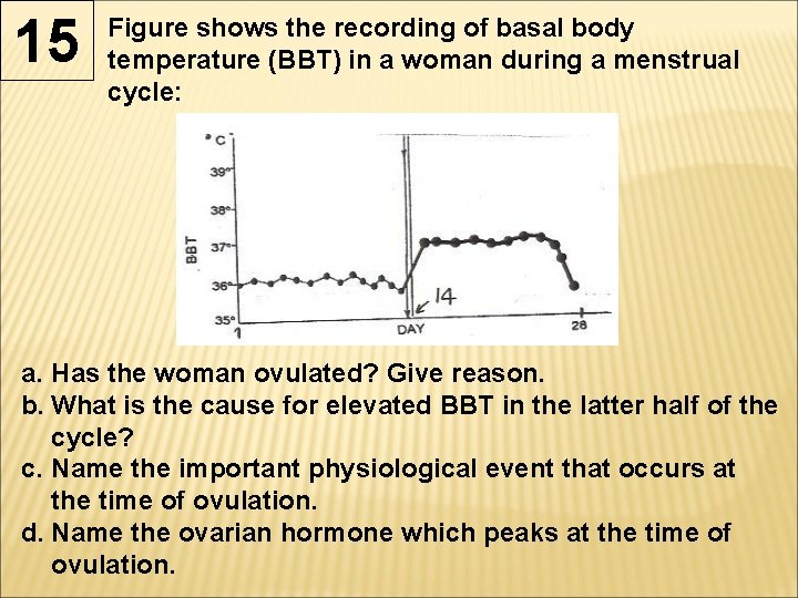 15 Figure shows the recording of basal body temperature (BBT) in a woman during 15 Figure shows the recording of basal body temperature (BBT) in a woman during