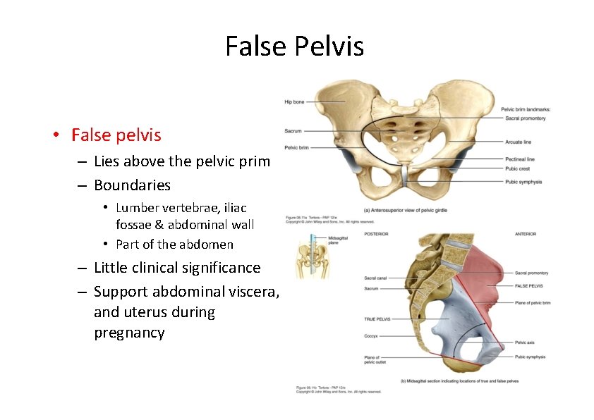 False Pelvis • False pelvis – Lies above the pelvic prim – Boundaries •