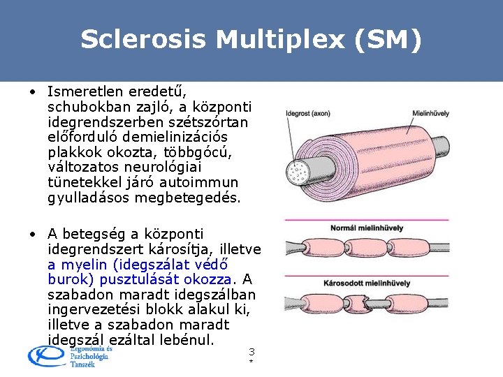 Sclerosis Multiplex (SM) • Ismeretlen eredetű, schubokban zajló, a központi idegrendszerben szétszórtan előforduló demielinizációs