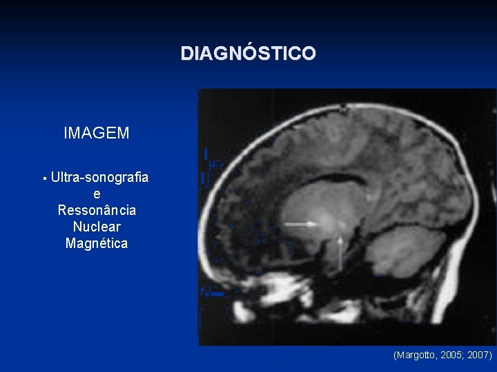 DIAGNÓSTICO IMAGEM § Ultra-sonografia e Ressonância Nuclear Magnética (Margotto, 2005; 2007) 