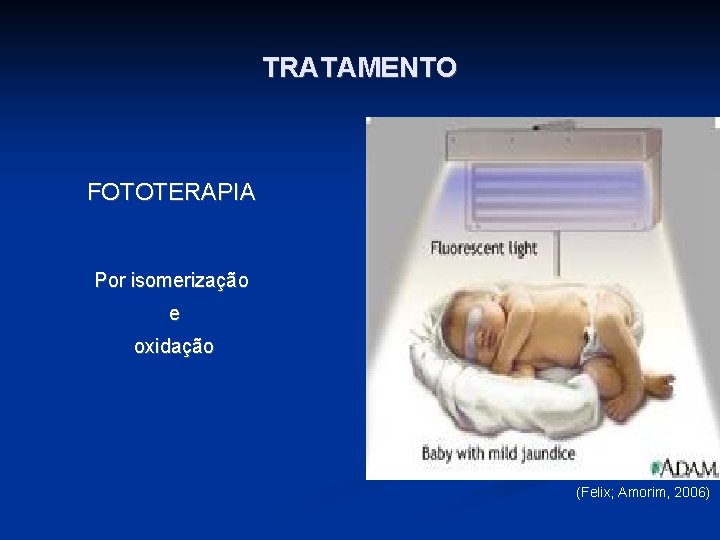 TRATAMENTO FOTOTERAPIA Por isomerização e oxidação (Felix; Amorim, 2006) 