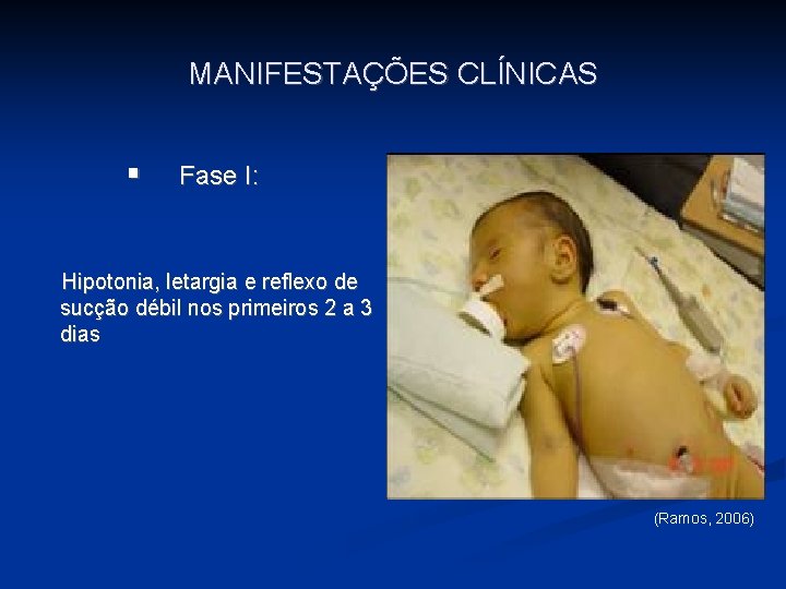 MANIFESTAÇÕES CLÍNICAS § Fase I: Hipotonia, letargia e reflexo de sucção débil nos primeiros