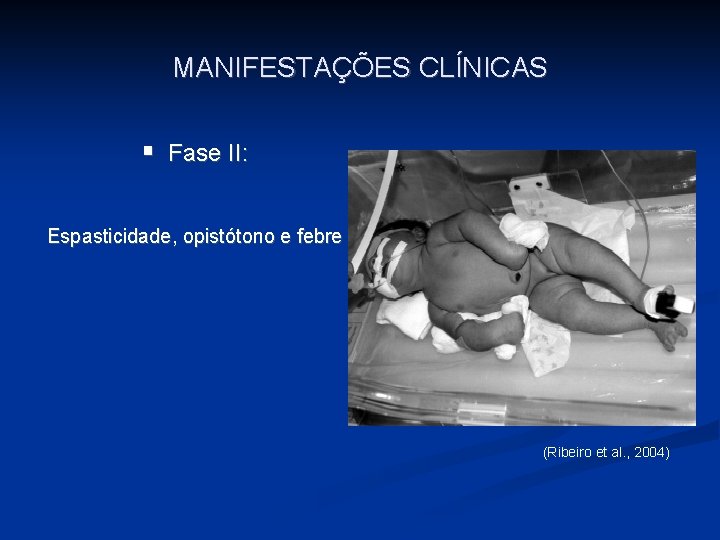 MANIFESTAÇÕES CLÍNICAS § Fase II: Espasticidade, opistótono e febre (Ribeiro et al. , 2004)