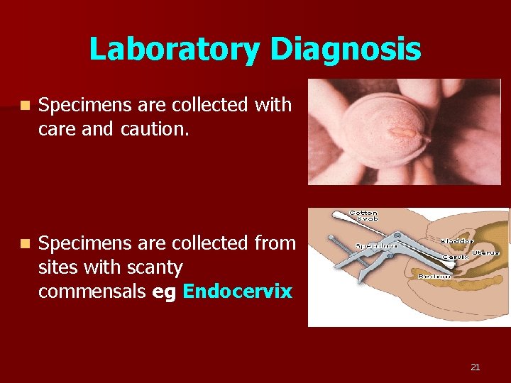 Laboratory Diagnosis n Specimens are collected with care and caution. n Specimens are collected