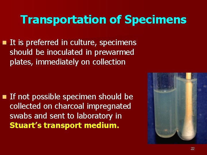 Transportation of Specimens n It is preferred in culture, specimens should be inoculated in
