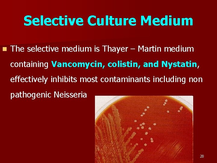 Selective Culture Medium n The selective medium is Thayer – Martin medium containing Vancomycin,