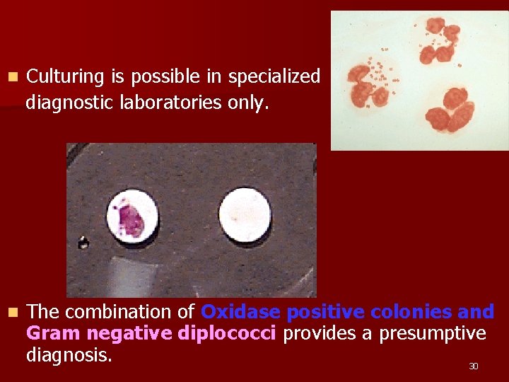 Culturing is possible in specialized diagnostic laboratories only. n n The combination of Oxidase