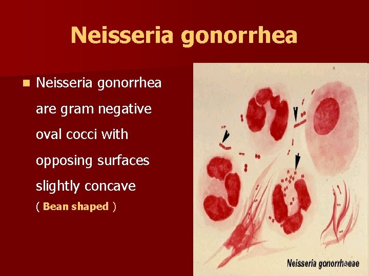 Neisseria gonorrhea n Neisseria gonorrhea are gram negative oval cocci with opposing surfaces slightly