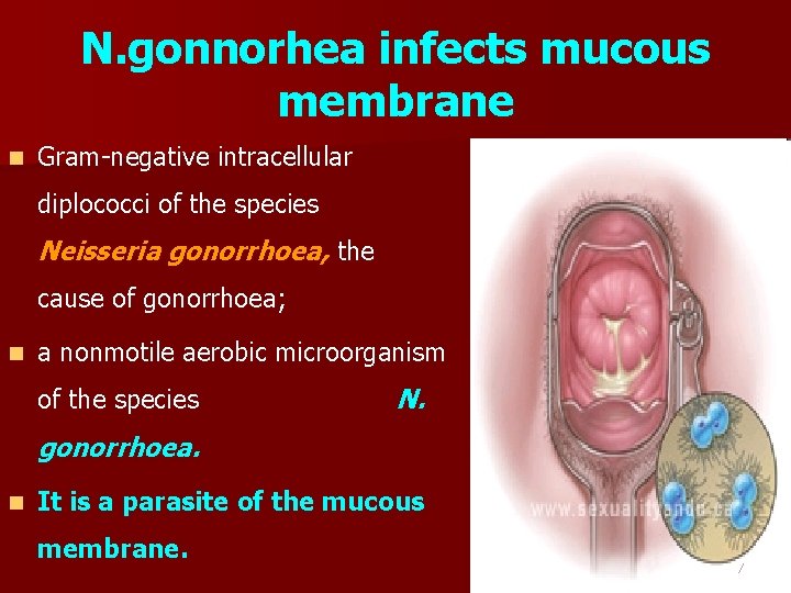 N. gonnorhea infects mucous membrane n Gram-negative intracellular diplococci of the species Neisseria gonorrhoea,