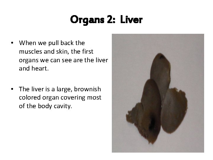 Organs 2: Liver • When we pull back the muscles and skin, the first