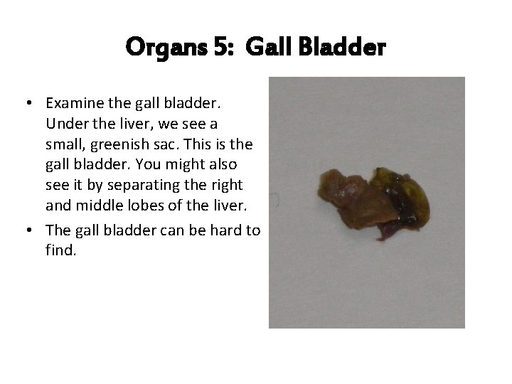 Organs 5: Gall Bladder • Examine the gall bladder. Under the liver, we see