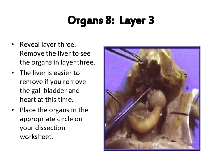 Organs 8: Layer 3 • Reveal layer three. Remove the liver to see the
