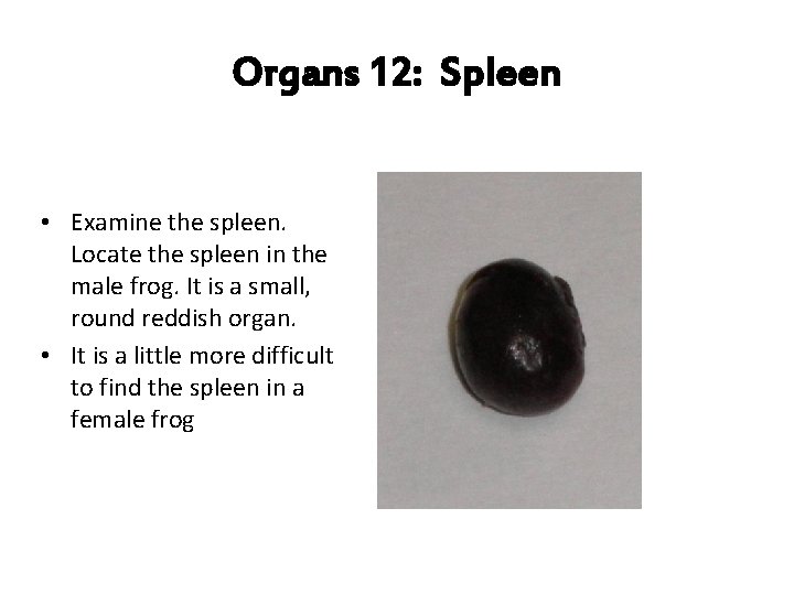 Organs 12: Spleen • Examine the spleen. Locate the spleen in the male frog.