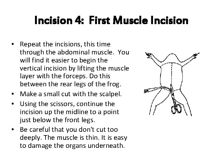 Incision 4: First Muscle Incision • Repeat the incisions, this time through the abdominal