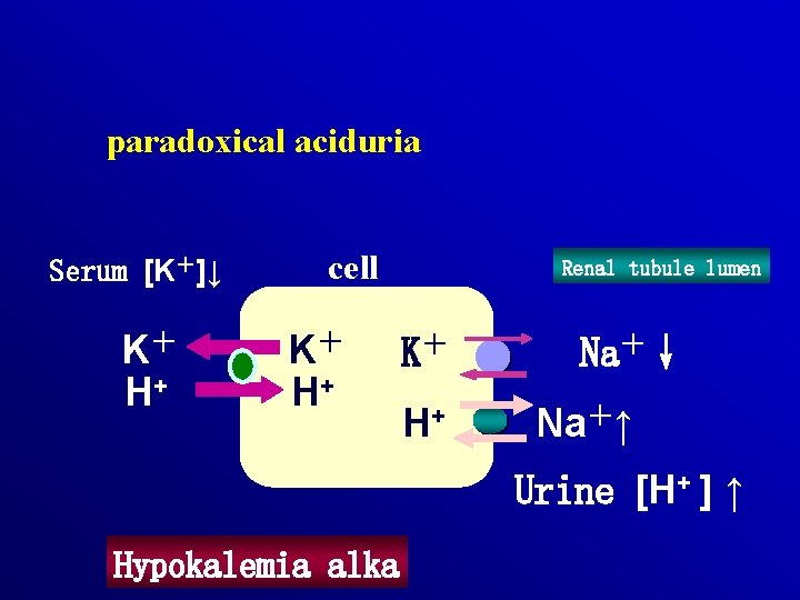 paradoxical aciduria Serum [K＋]↓ K＋ H+ cell K＋ H+ Renal tubule lumen K＋ H+