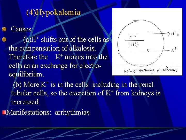 (4)Hypokalemia Causes: (a)H+ shifts out of the cells as the compensation of alkalosis. Therefore