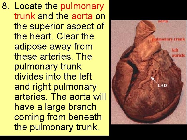 8. Locate the pulmonary trunk and the aorta on the superior aspect of the