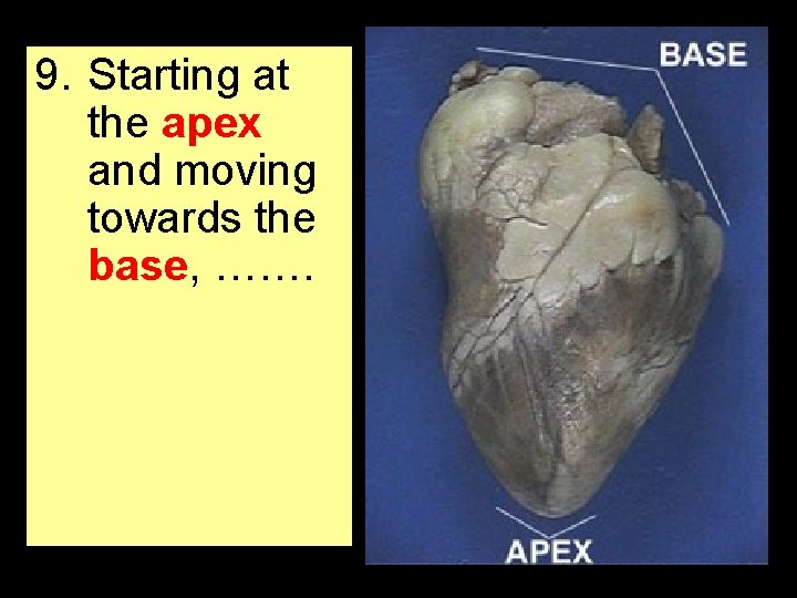 9. Starting at the apex and moving towards the base, ……. 