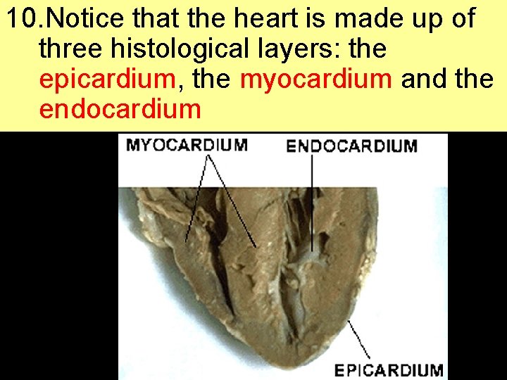 10. Notice that the heart is made up of three histological layers: the epicardium,