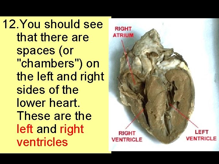 12. You should see that there are spaces (or "chambers") on the left and