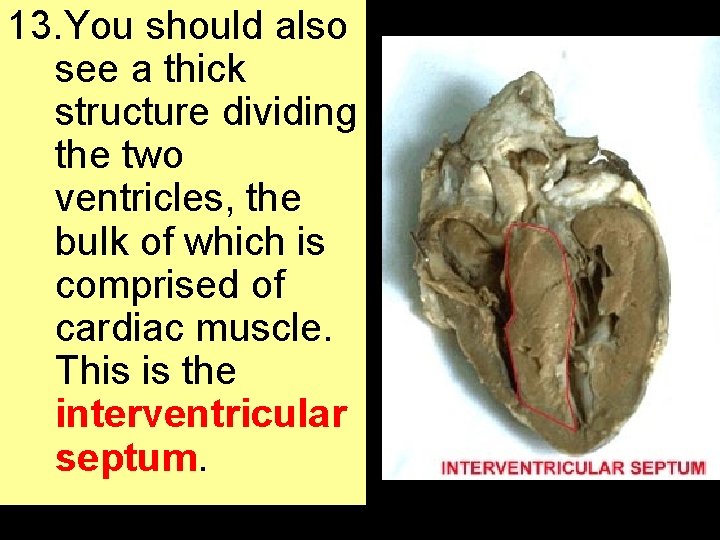 13. You should also see a thick structure dividing the two ventricles, the bulk