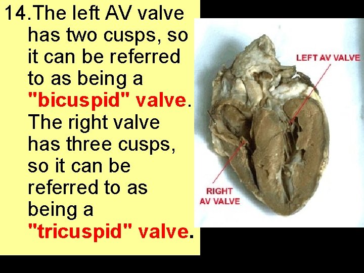 14. The left AV valve has two cusps, so it can be referred to