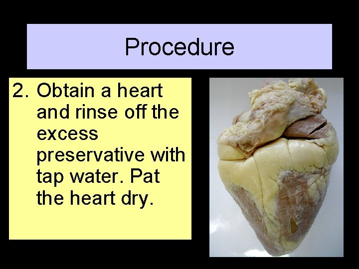 Procedure 2. Obtain a heart and rinse off the excess preservative with tap water.