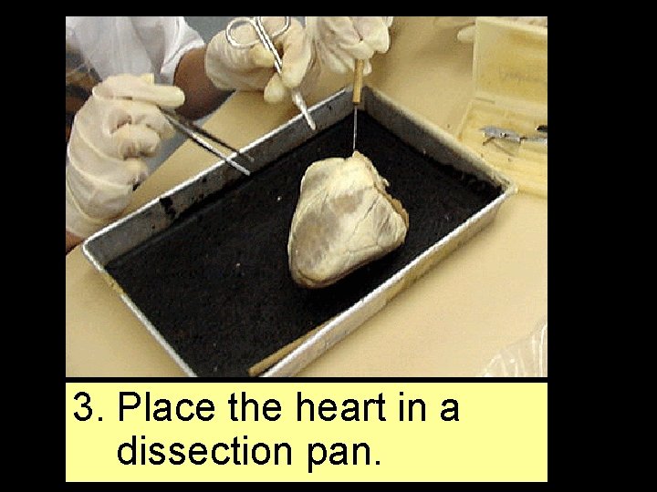 3. Place the heart in a dissection pan. 