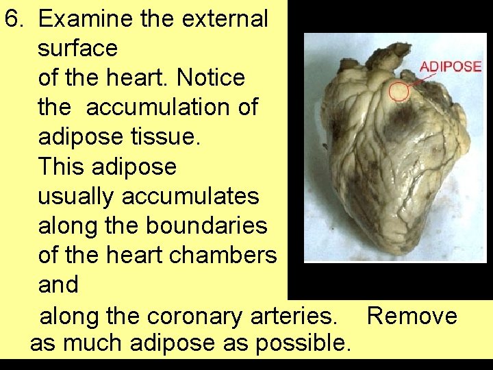6. Examine the external surface of the heart. Notice the accumulation of adipose tissue.