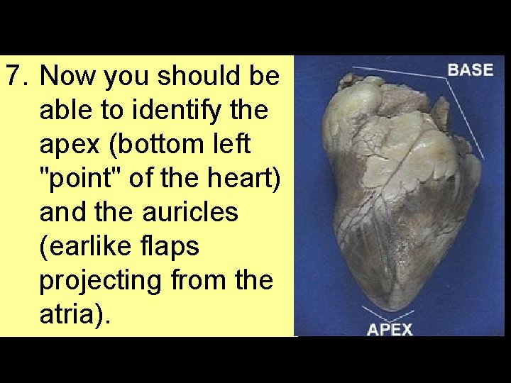 7. Now you should be able to identify the apex (bottom left "point" of