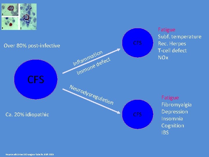 Over 80% post-infective CFS Ca. 20% idiopathic Neuroendokrine Störungen-Tabelle. Bild-2005 CFS tion a m