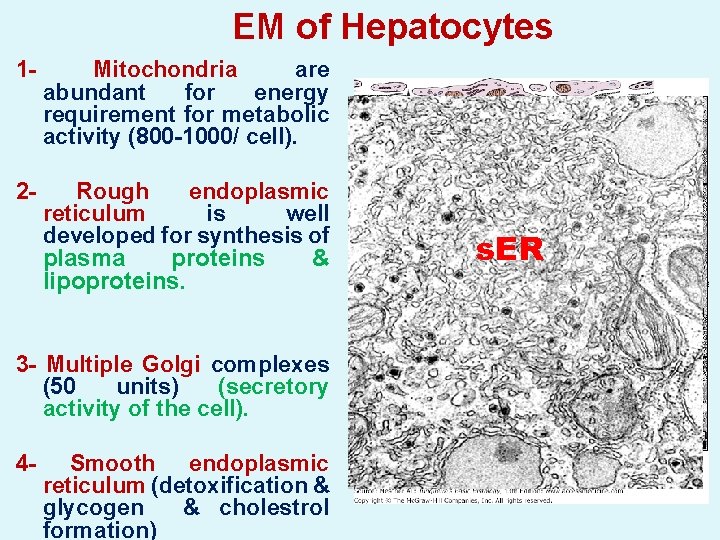 EM of Hepatocytes 1 - Mitochondria are abundant for energy requirement for metabolic activity