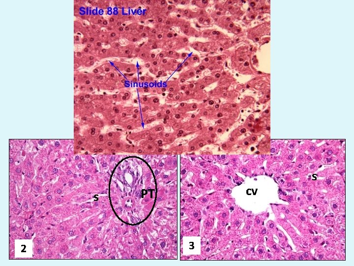 cv 1 a s 2 s cv PT 3 s 