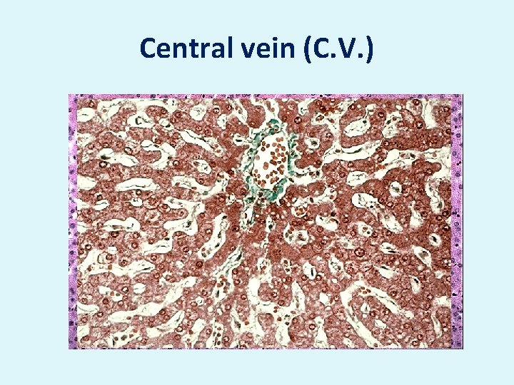 Central vein (C. V. ) 