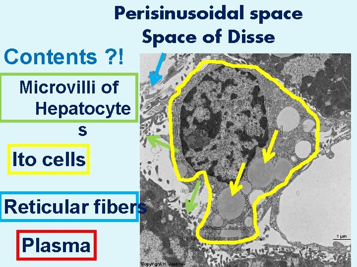 Perisinusoidal space Space of Disse Contents ? ! Microvilli of Hepatocyte s Ito cells