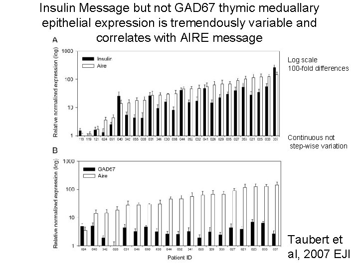 Insulin Message but not GAD 67 thymic meduallary epithelial expression is tremendously variable and