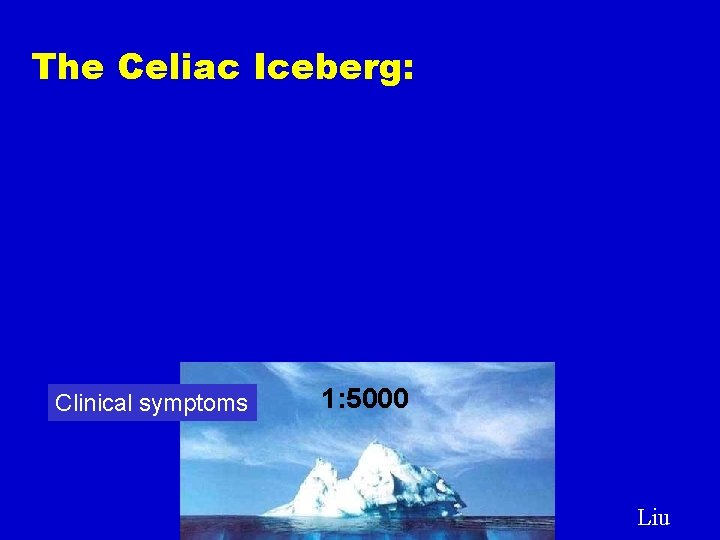 The Celiac Iceberg: Clinical symptoms 1: 5000 Liu 