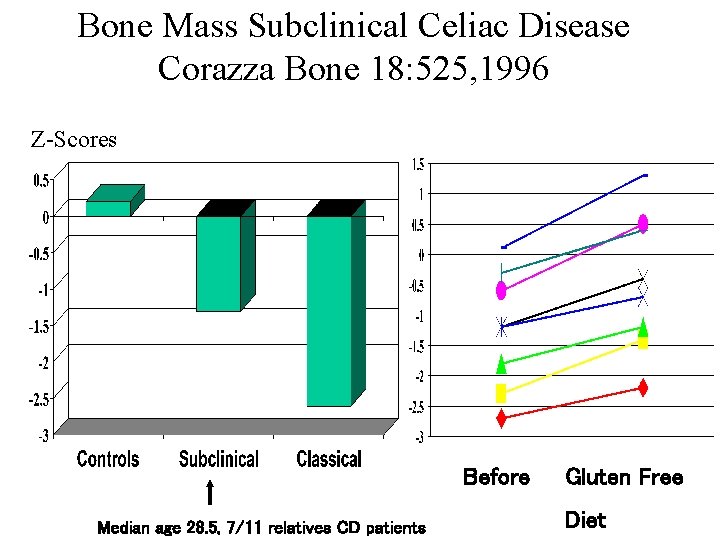 Bone Mass Subclinical Celiac Disease Corazza Bone 18: 525, 1996 Z-Scores Before Median age