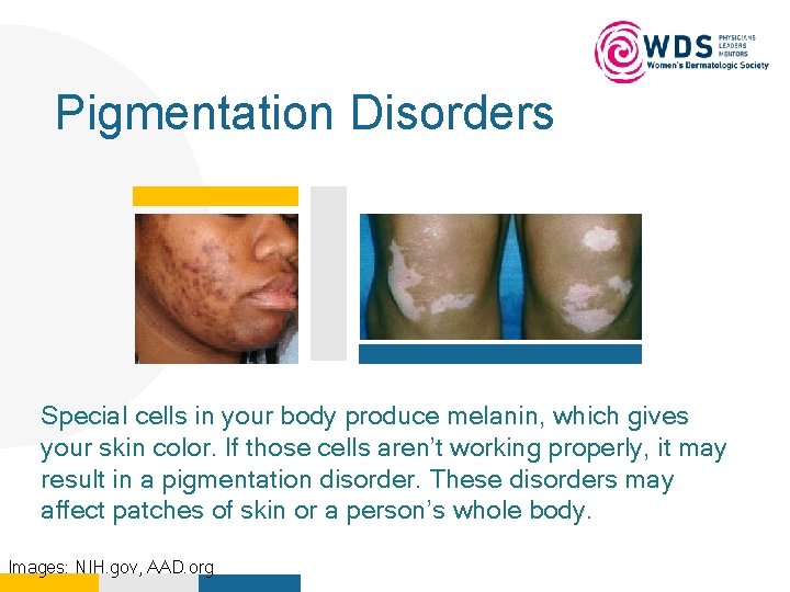 Pigmentation Disorders Your Logo Here Special cells in your body produce melanin, which gives