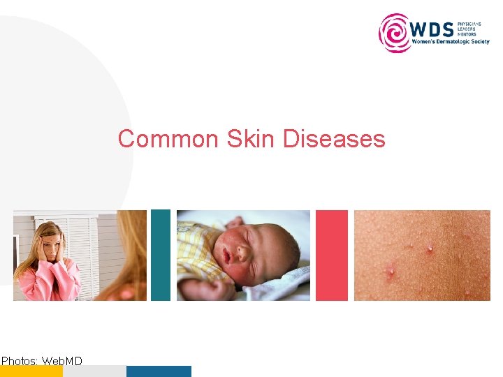 Your Logo Here Common Skin Diseases Photos: Web. MD 