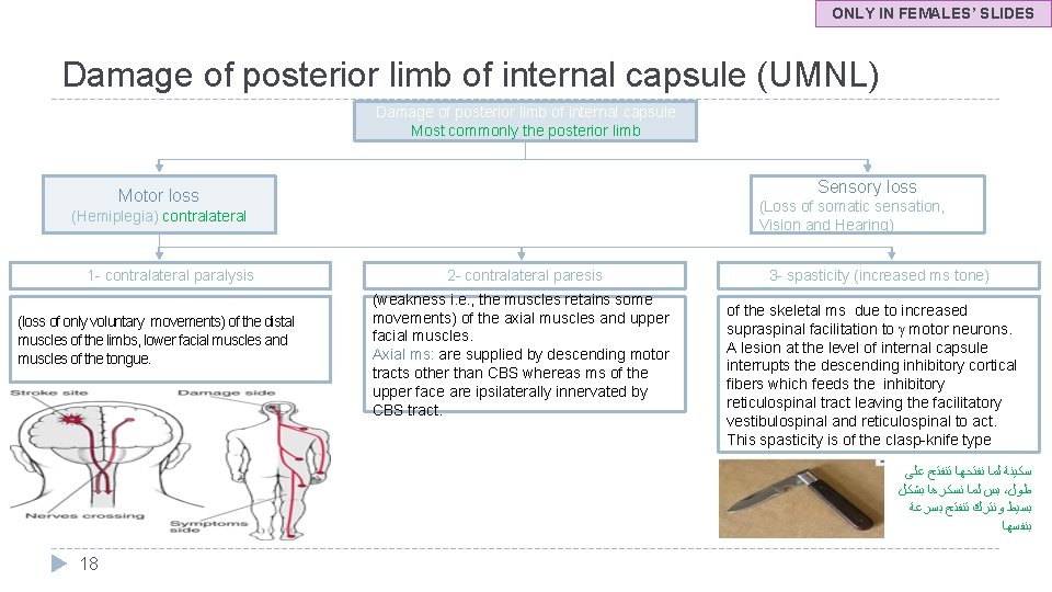 ONLY IN FEMALES’ SLIDES Damage of posterior limb of internal capsule (UMNL) Damage of