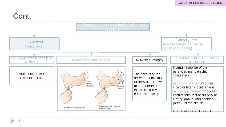 ONLY IN FEMALES’ SLIDES Cont. Damage of posterior limb of internal capsule Sensory loss