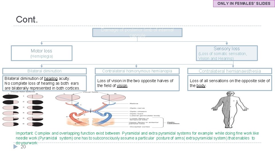 ONLY IN FEMALES’ SLIDES Cont. Damage of posterior limb of internal capsule Sensory loss