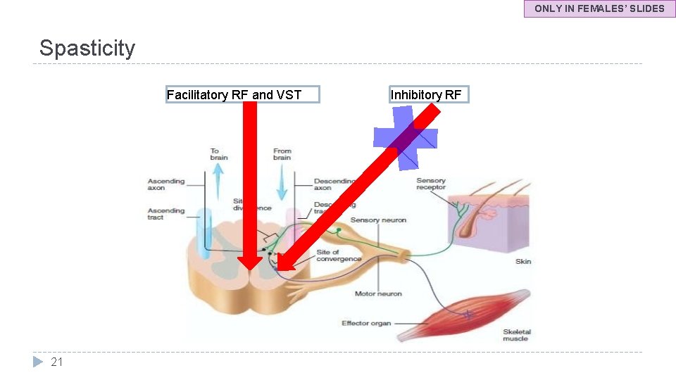 ONLY IN FEMALES’ SLIDES Spasticity Facilitatory RF and VST 21 Inhibitory RF 