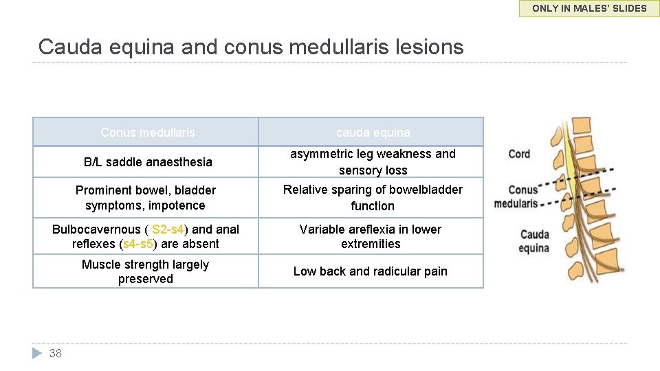 ONLY IN MALES’ SLIDES Cauda equina and conus medullaris lesions Conus medullaris cauda equina