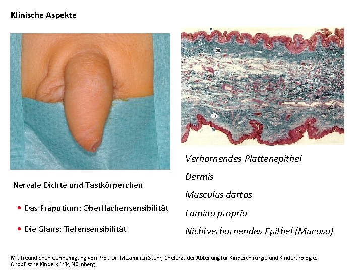 Klinische Aspekte Verhornendes Plattenepithel Nervale Dichte und Tastkörperchen Dermis Musculus dartos • Das Präputium:
