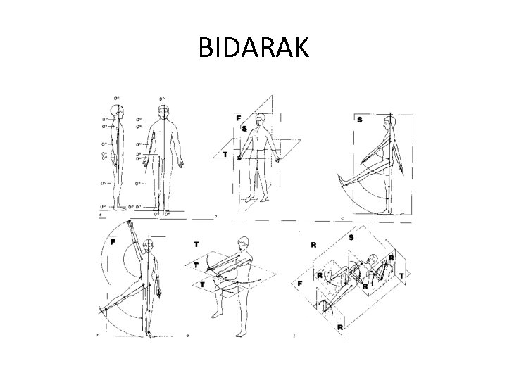 BIDARAK 